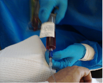 Chemotherapy Liquid Injection